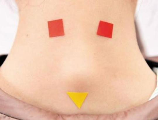 富貴包抽脂有用嗎?人瘦了富貴包會(huì)消失嗎 富貴包抽脂有用嗎?人瘦了富貴包會(huì)消失嗎