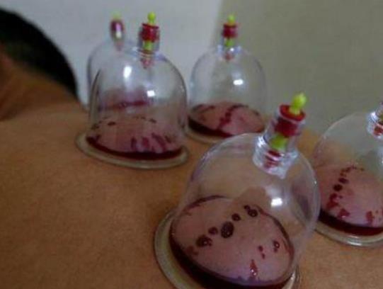 �ι޺�Ƥ�w�ɫ����������ι޲��ܰ��Ă�λ��