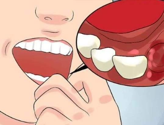 �������X������ô�坍���a������Ó���ԭ����ʲô