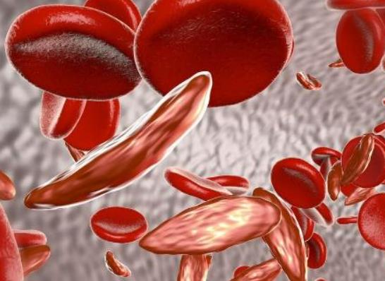 ��Ѫ����ʲôΣ�U��ʲô�ǵ�Ѫ�Ƿ�����