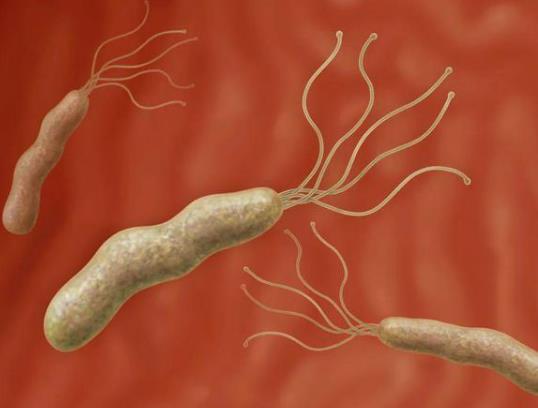 ���T�ݗU����ʲô���ί������T�ݗU����Ⱦ��ô�k