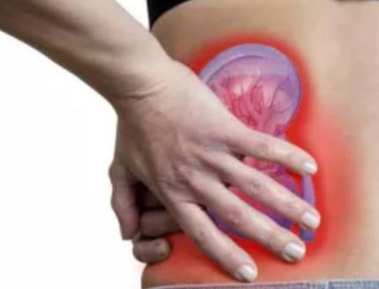 腎結石怎么止痛最快?吃哪些東西容易得腎結石 腎結石怎么止痛最快?吃哪些東西容易得腎結石