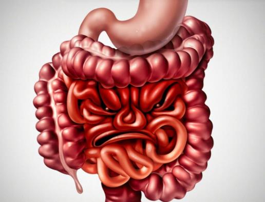 結腸炎怎么診斷?結腸炎吃益生菌有用嗎 結腸炎怎么診斷?結腸炎吃益生菌有用嗎