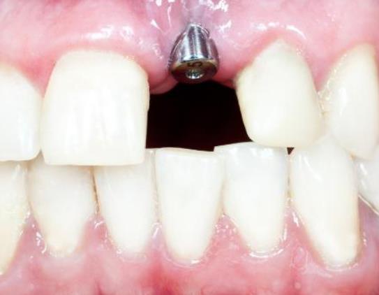 �C�����X��Σ����ʲô���Nֲ���X�ă��c