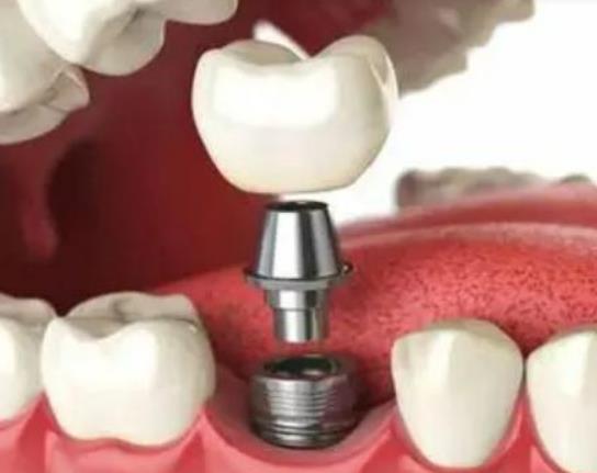 �Nֲһ�w���X�����X���Nֲ�x�X�ޏ�Ҫ���