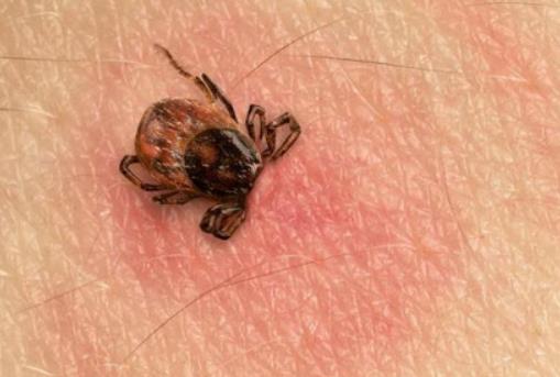 �[���x����ô���ģ��[���xҧ�İ���ɶ����