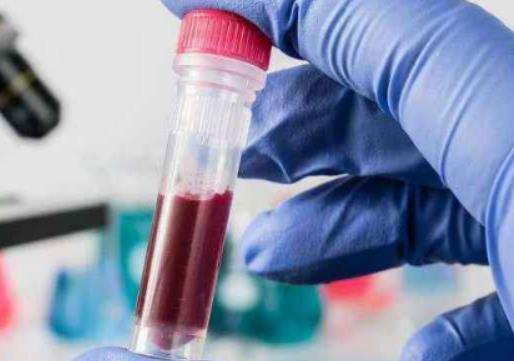 ���̲�ԇ����^��һ���ԵĆ᣿���̲��������ϕ��LЩɶ