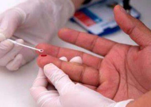 正常人群里艾滋病多嗎?艾滋病先從哪里癢 正常人群里艾滋病多嗎?艾滋病先從哪里癢